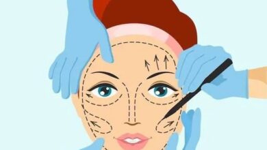 What is a Deep Plane Facelift